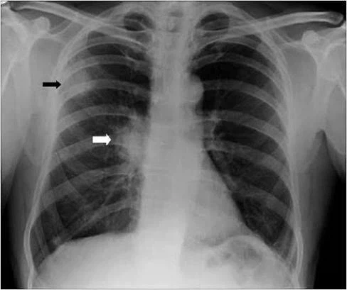 의외로 남자들이 무서워하는 엑스레이 사진.jpg_1.webp