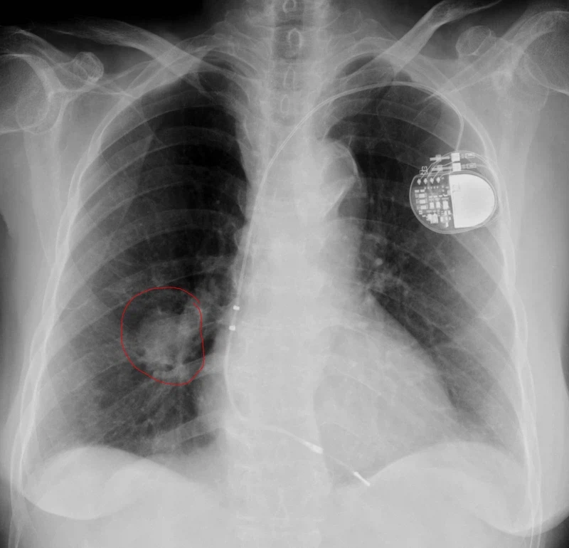 의외로 남자들이 무서워하는 엑스레이 사진.jpg_2.webp