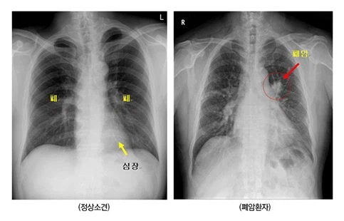 의외로 남자들이 무서워하는 엑스레이 사진.jpg_3.webp