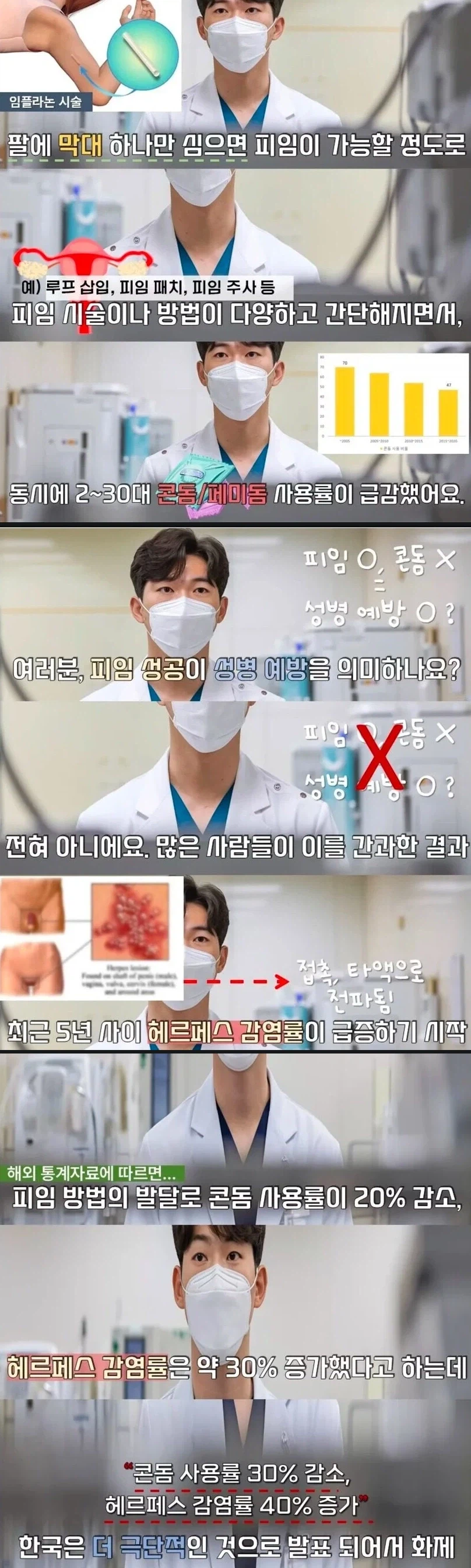 피임 기술이 좋아지자 생기는 부작용_1.webp