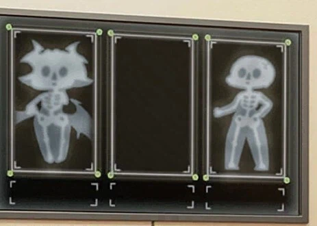 트릭컬)볼따구 세계의 X레이 사진_1.webp