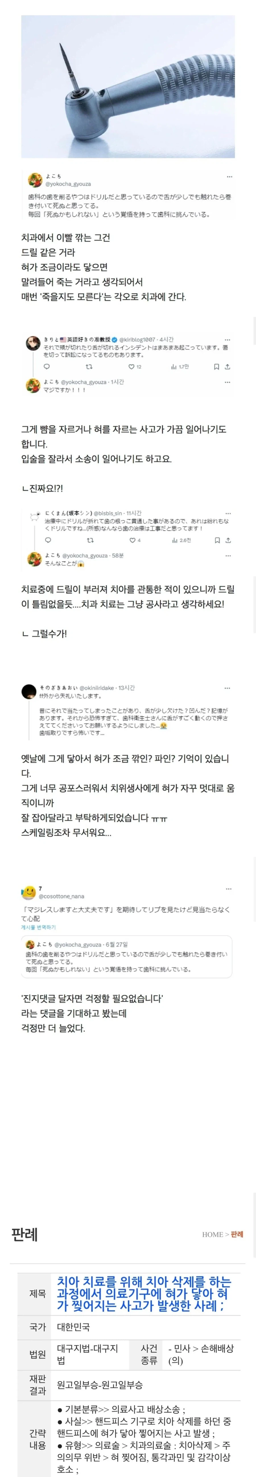 치과 드릴이 혀에 닿을까봐 무서워요.jpg_1.webp