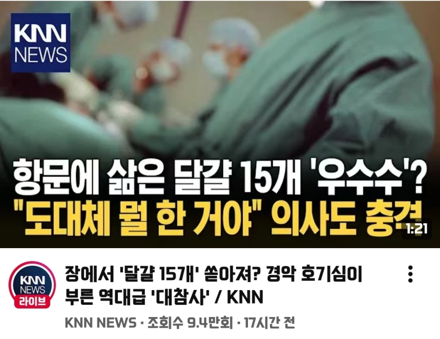 삶은 계란 비즈_1.webp