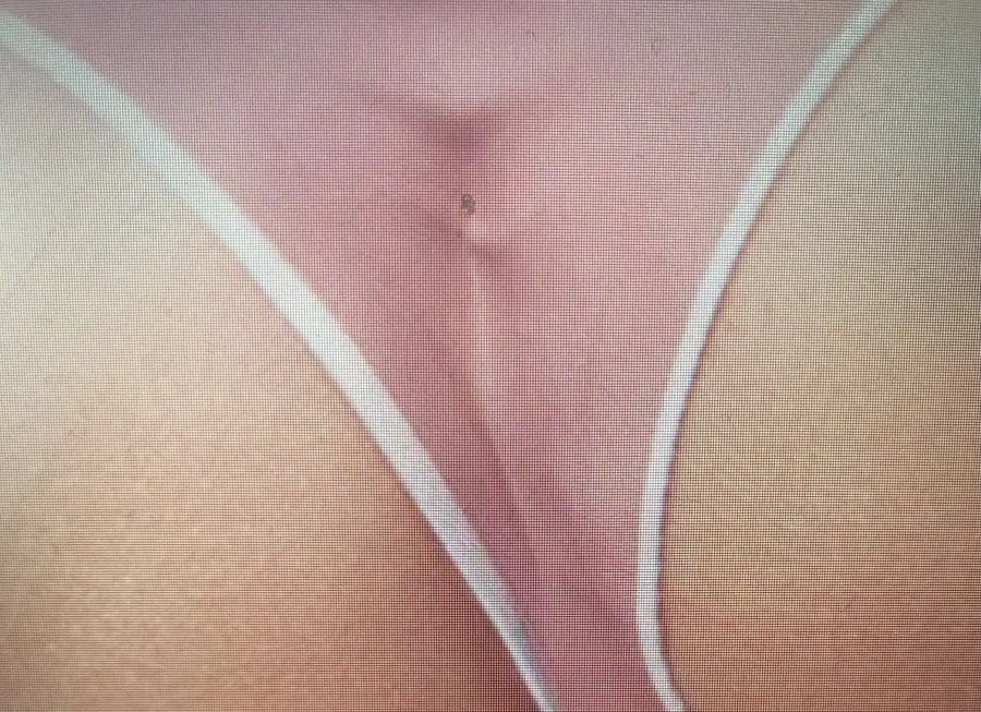 만우절을 위해 아껴둔 화상 공개_2.webp