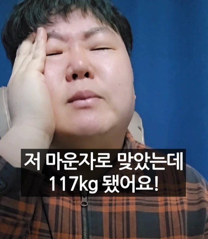 마운자로 맞고 몸무게 117kg이 된 제주 유튜버_1.webp