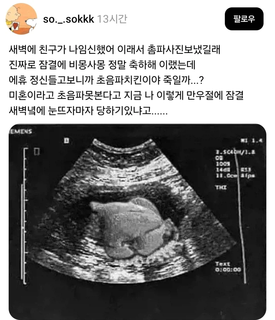 임신했다는 친구의 초음파 사진.jpg_1.webp