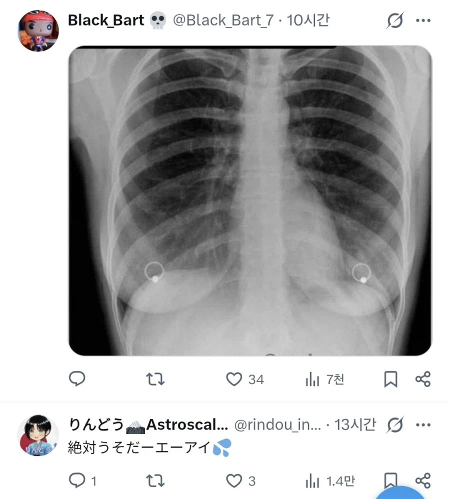 엑스레이 촬영 참사_1.webp