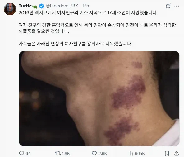 키스마크로 사망한 17세 소년_1.webp