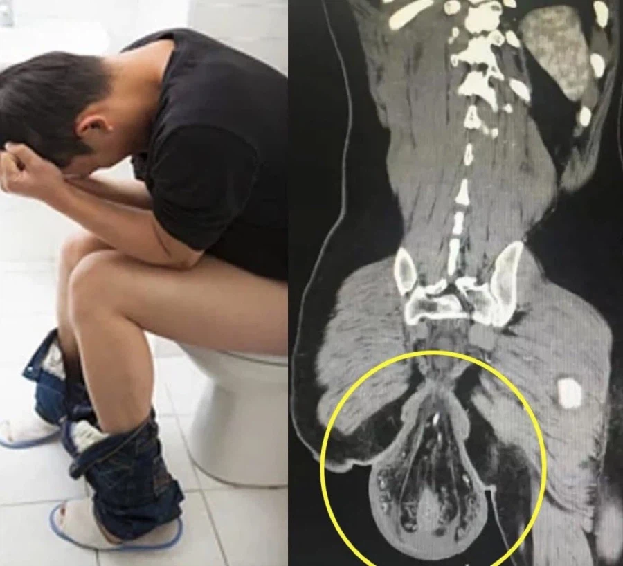 약혐) 화장실에서 똥 오래싸면 안되는 이유_1.webp