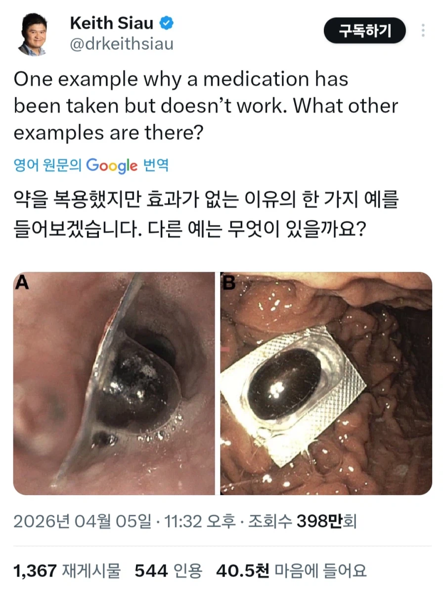 약혐) 약을 복용했는데 효과가 없는 이유 중 한 가지 예시_1.webp