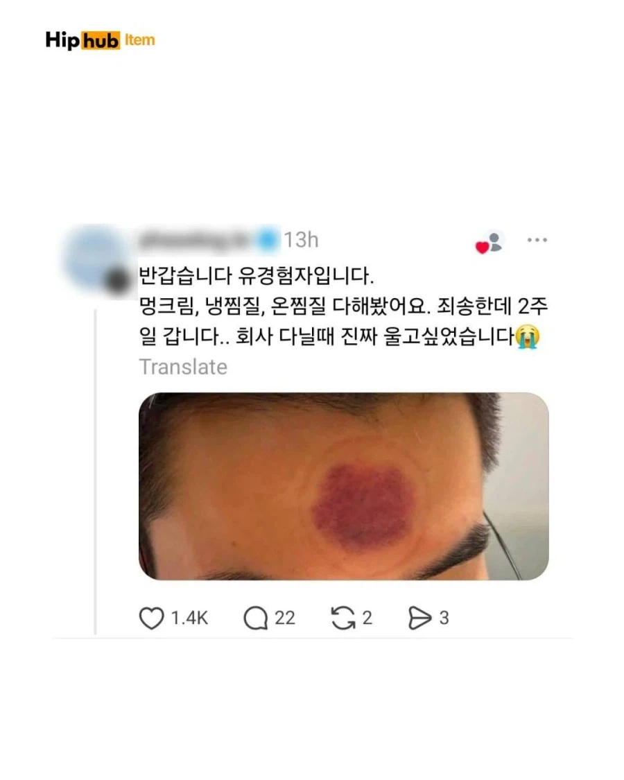 의외로 피해자가 속출했던 아기 용품_3.webp