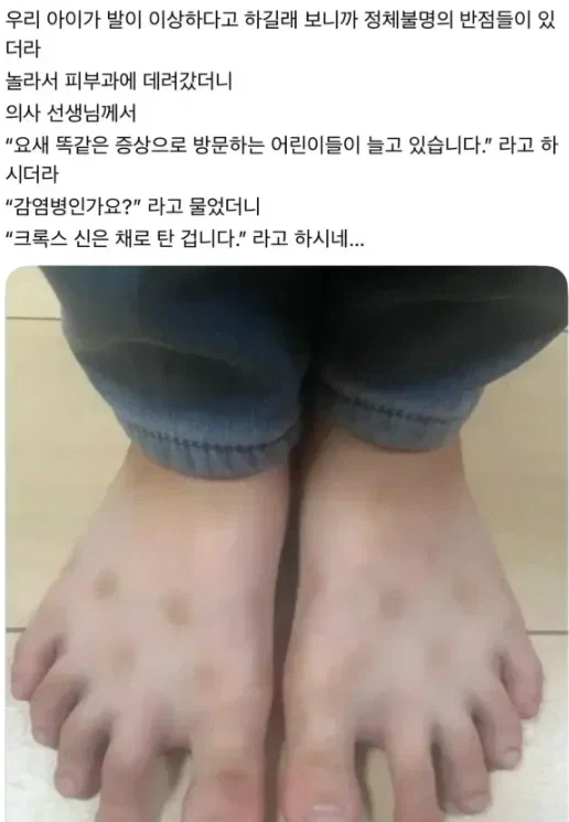 여름에 흔히들 걸린다는 피부병 증상_1.webp