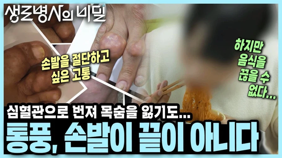 통풍 다큐멘터리 보면 통풍 = 식습관임 ㅋㅋㅋ_4.webp