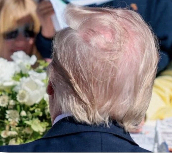 트럼프 뒷머리_1.webp