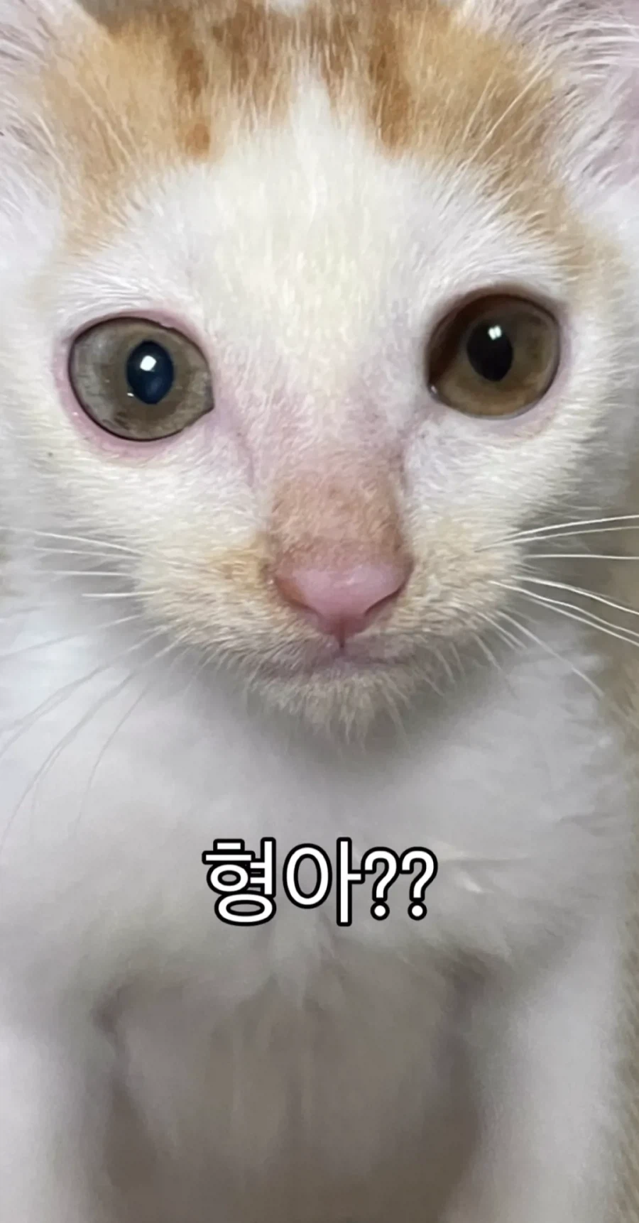 형아! 나 드디어 눈 기증 받게 됐대!_7.webp