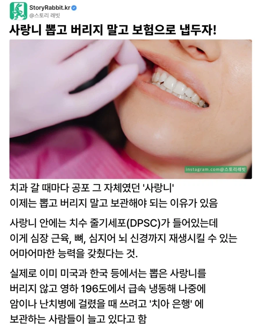 사랑니 뽑고 버리지 말고 보험으로 놔두자.jpg_1.webp