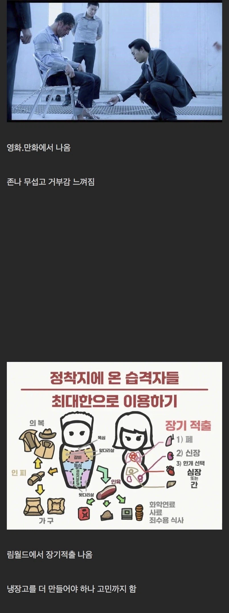 생각보다 장기적출이 별 거 아닌 이유_1.webp