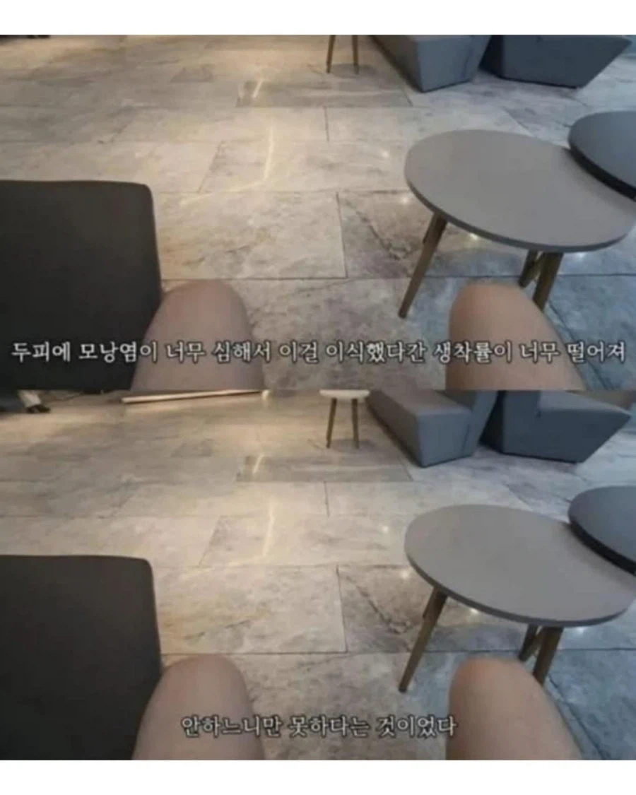 터키에 모발이식하러 갔더니 일어난 일 ㄷㄷㄷ_4.webp