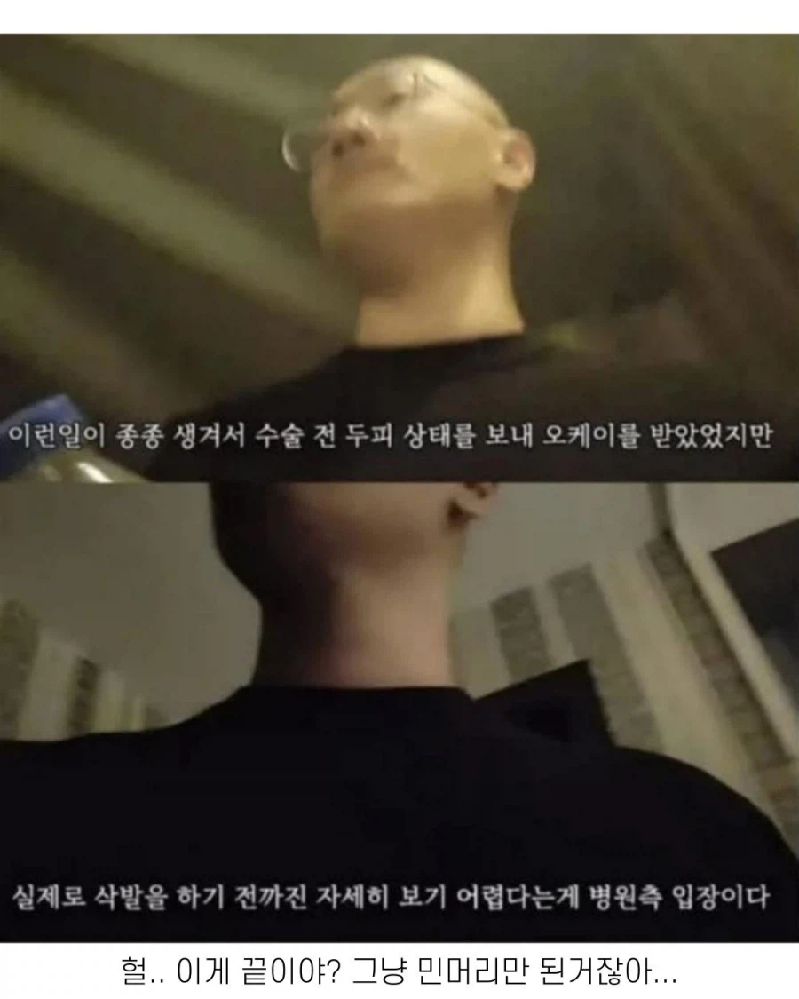 터키에 모발이식하러 갔더니 일어난 일 ㄷㄷㄷ_5.webp