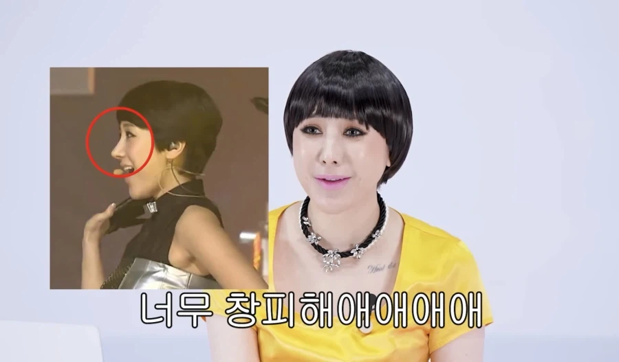 서인영 코(끝) 성형 5번 하기 전_13.webp