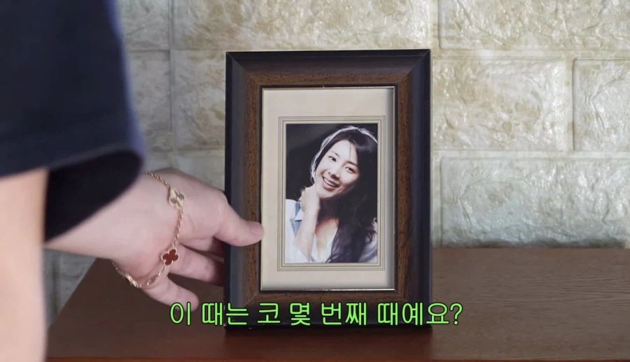 서인영 코(끝) 성형 5번 하기 전_14.webp