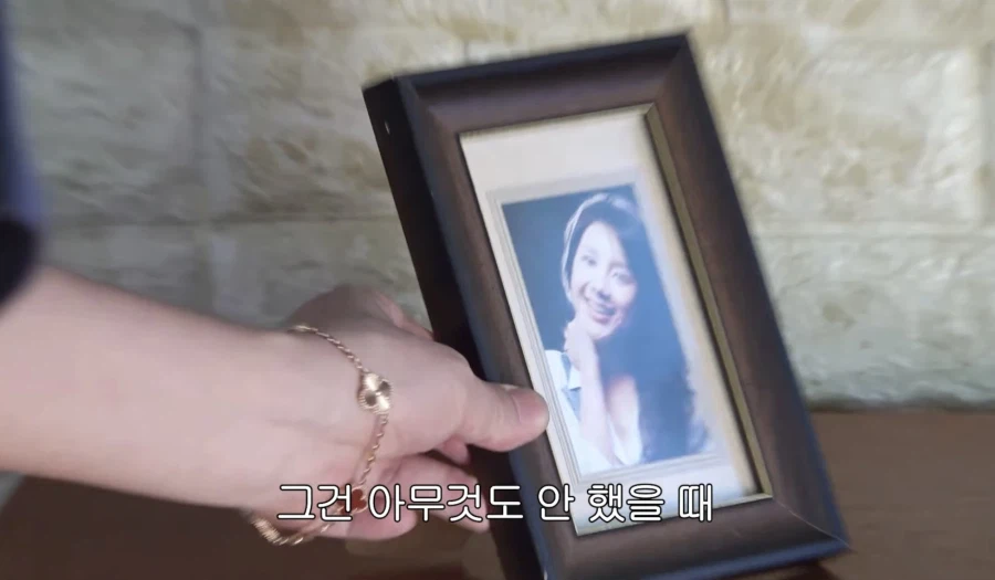 서인영 코(끝) 성형 5번 하기 전_15.webp