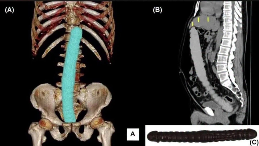 의외로 고증에 부합한다는 짤.jpg_2.webp