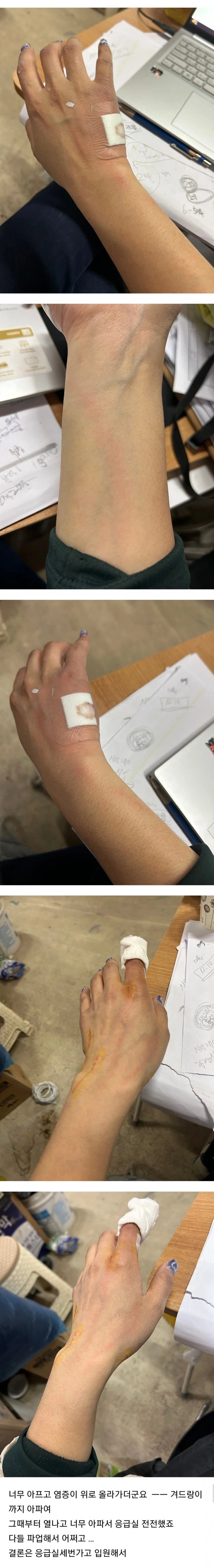 (혐) 고양이에게 물린 캣맘_4.webp