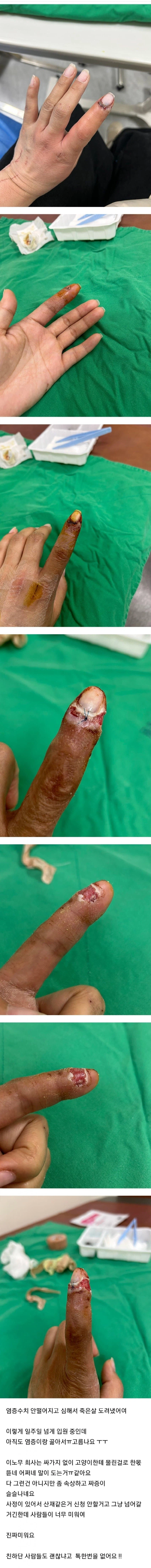 (혐) 고양이에게 물린 캣맘_5.webp