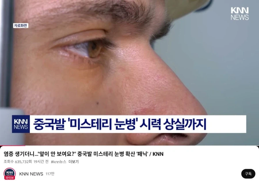 중국발 미스테리 눈병_1.webp