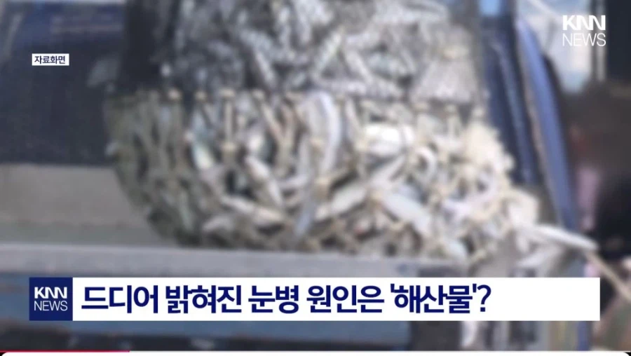 중국발 미스테리 눈병_2.webp