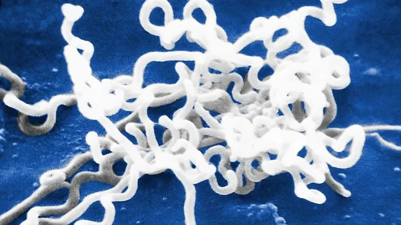 매독 유행당시 각 국가 상황_1.webp