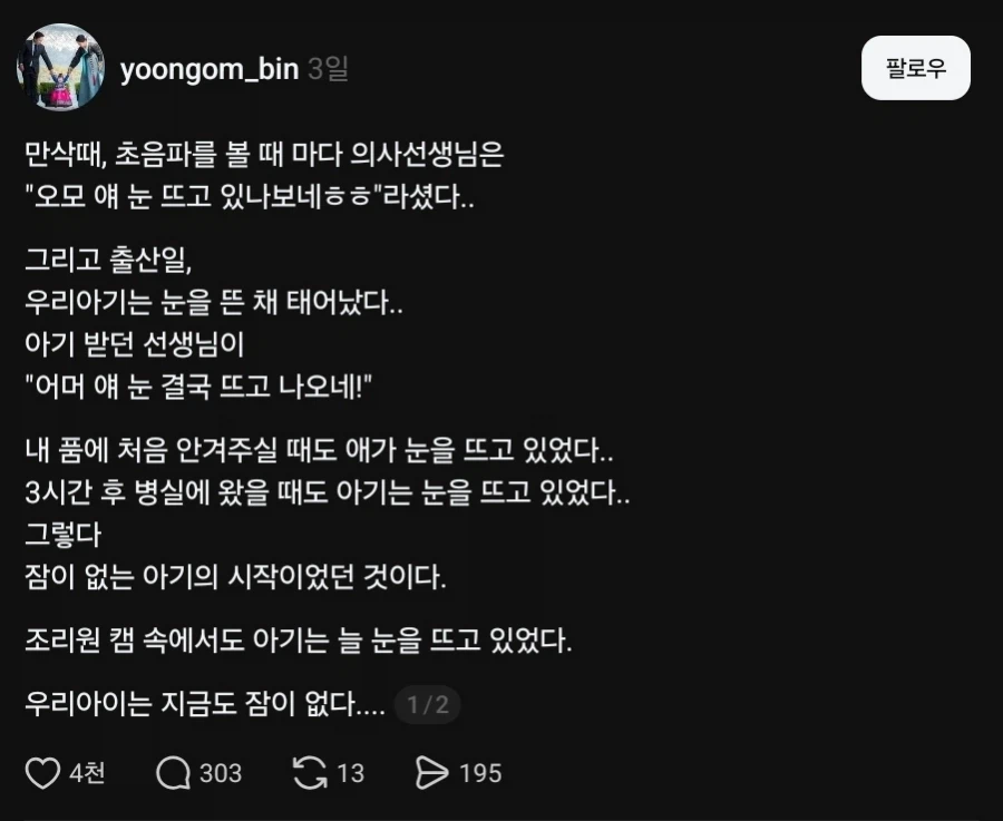 눈을 뜬 채 태어난 아기_1.webp