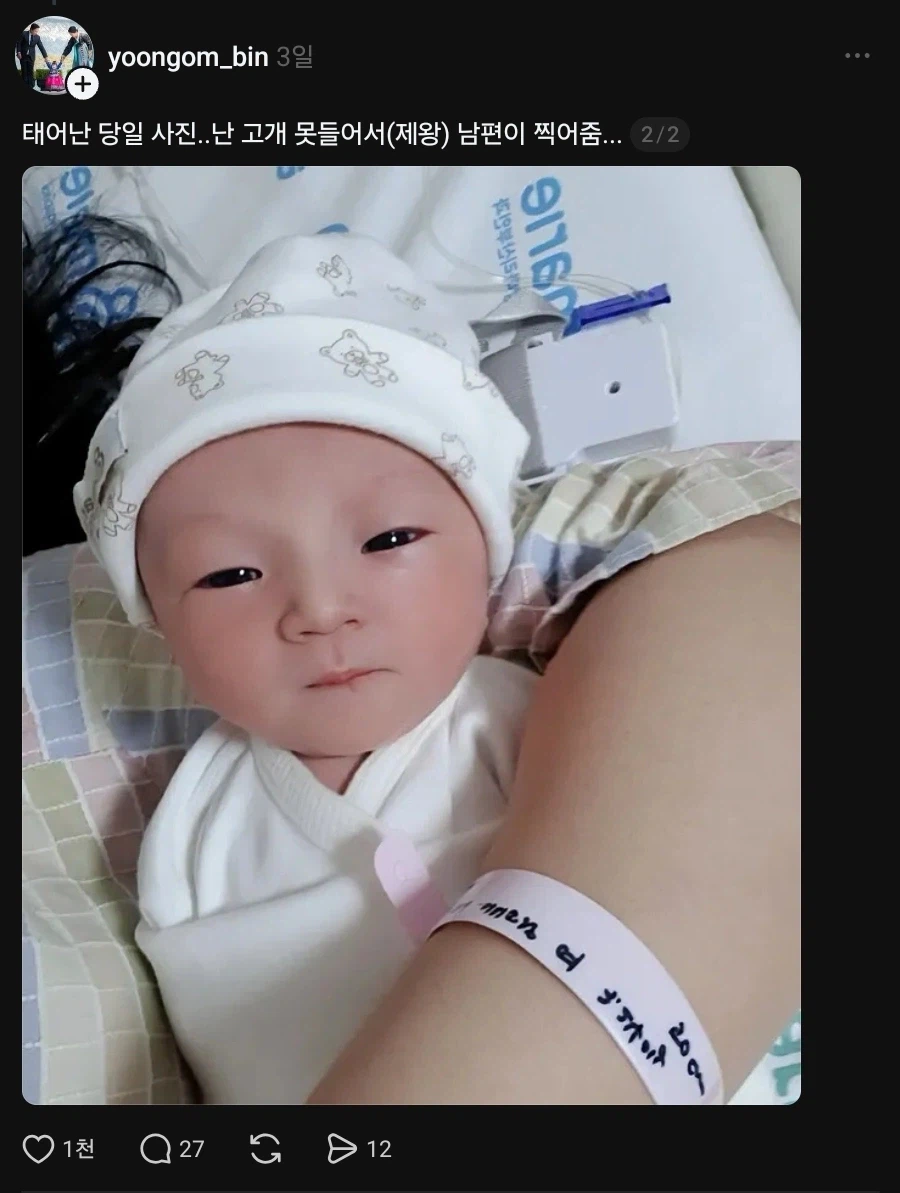 눈을 뜬 채 태어난 아기_2.webp