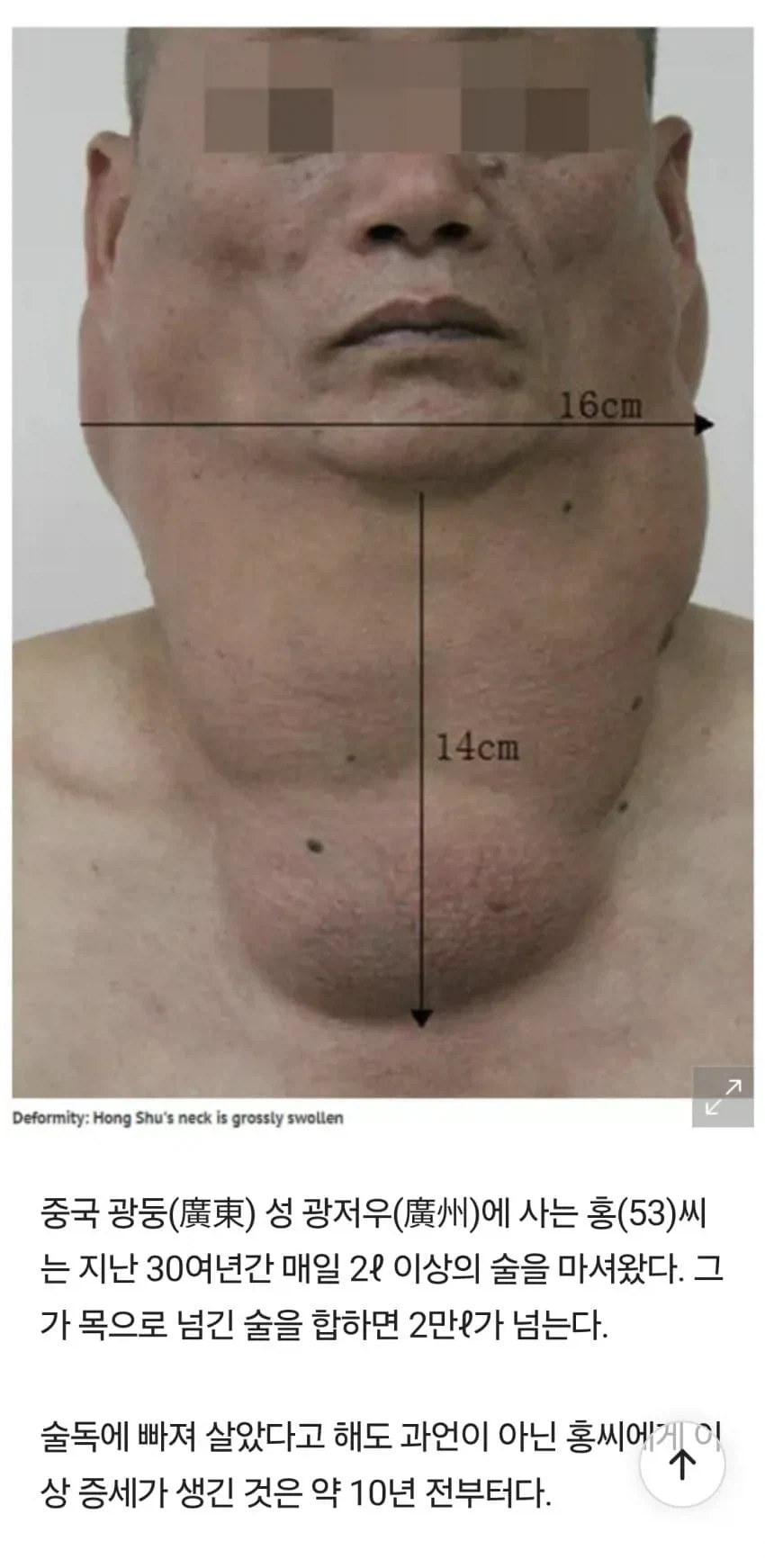 술을 물처럼 마시면 생기는 일.jpg_1.webp