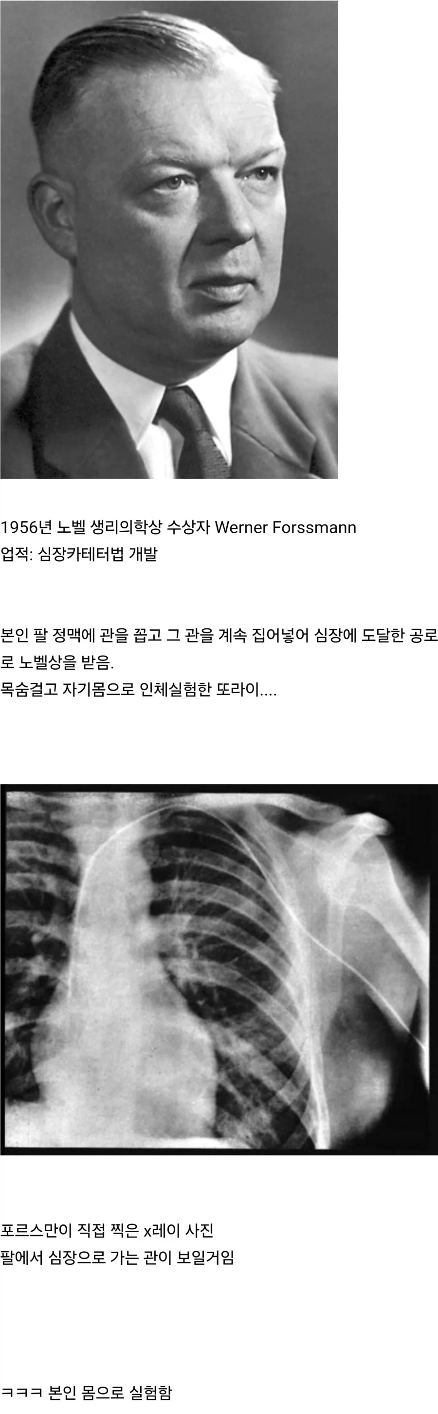 역대 노벨상 수상자 중 ㄸㄹㅇ 원탑_1.webp