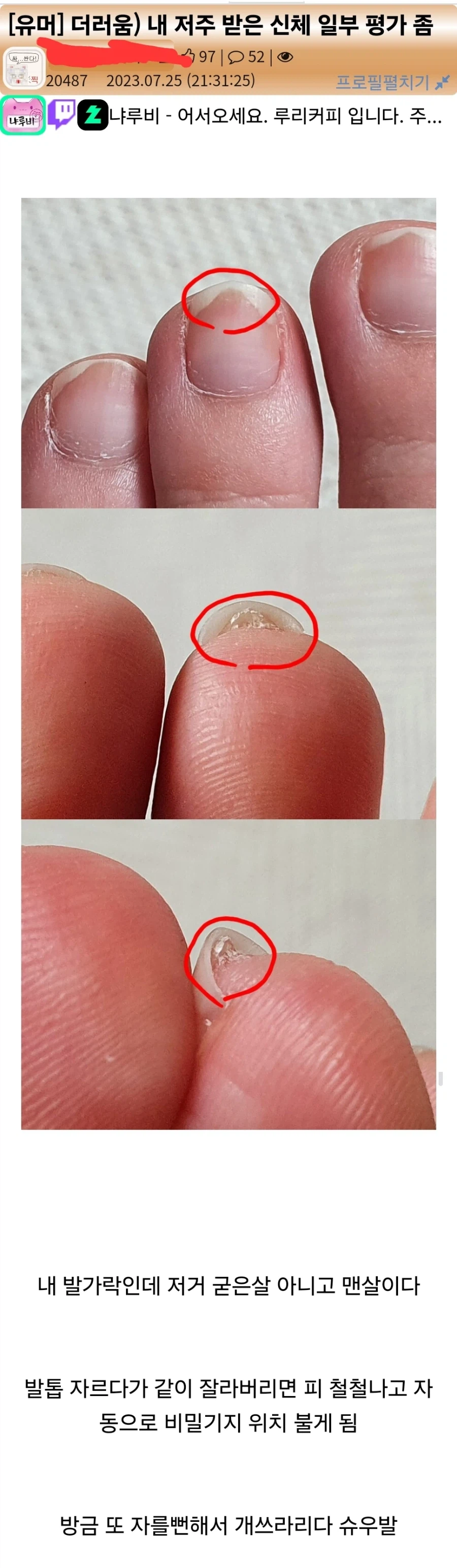 비밀기지 자유이용권 끊어주는 저주받은 발톱.jpg_1.webp