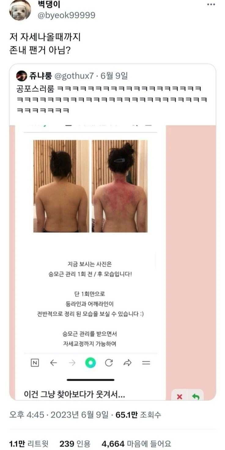 승모근 관리 후기_1.webp