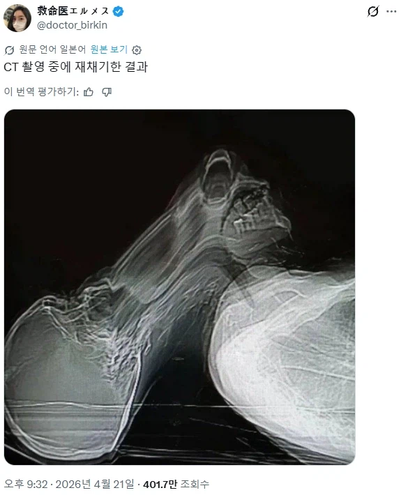 끔찍한 의료 사고_1.webp