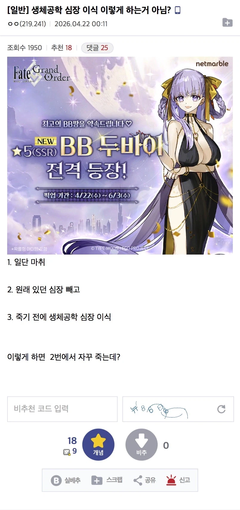 심장이식 이렇게 하는거 아님?_1.webp