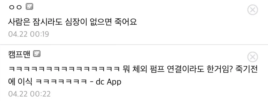 심장이식 이렇게 하는거 아님?_2.webp