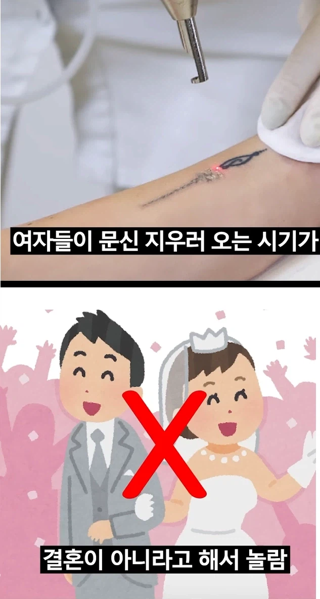 여성들의 문신을 제거하는 시기._2.webp