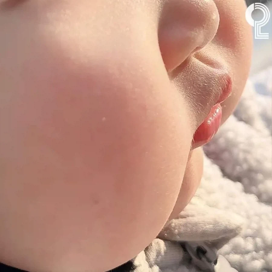깨물어주고 싶을 정도로 귀엽다란 표현이 생긴 이유_4.webp
