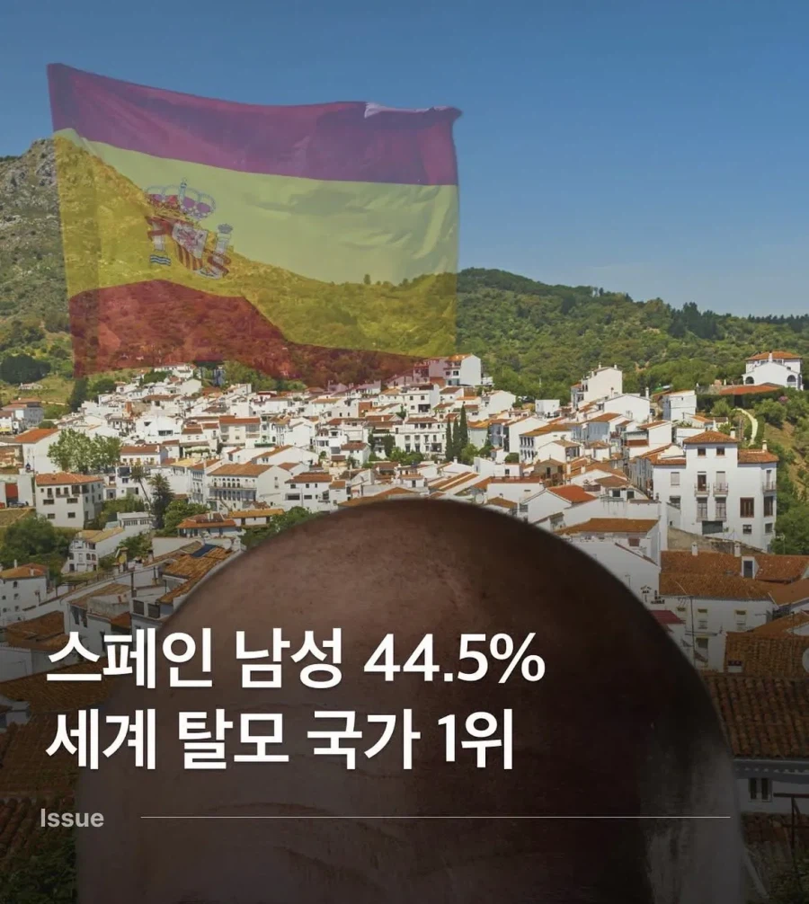 세계 탈모 국가 1위_1.webp