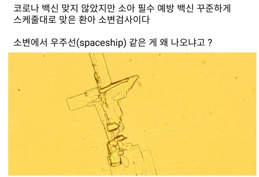 소변검사에서 드러난 백신의 위험성.jpg_2.webp