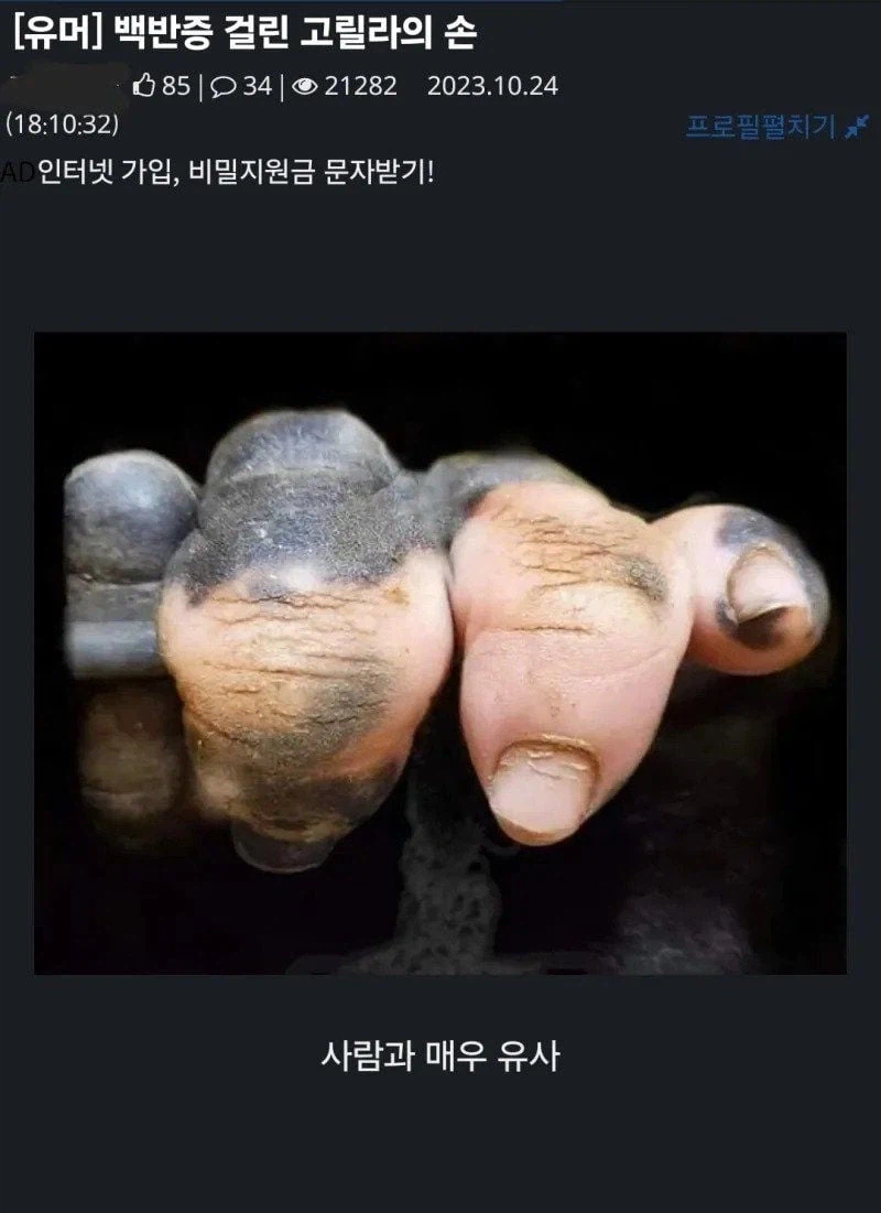 백반증 걸린 고릴라의 손._1.webp