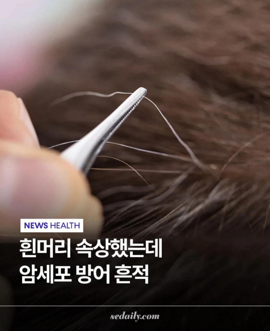 도쿄대에서 밝혀낸 흰머리의 비밀_1.webp