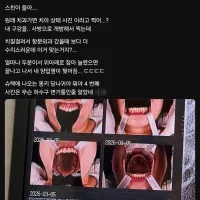 치과에서 수치 당한 사람
