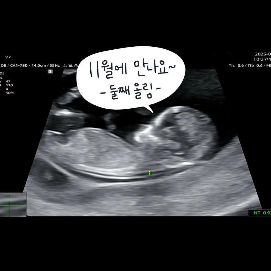 남편이 임신기간내내 해준 일 .manhwa_13.webp