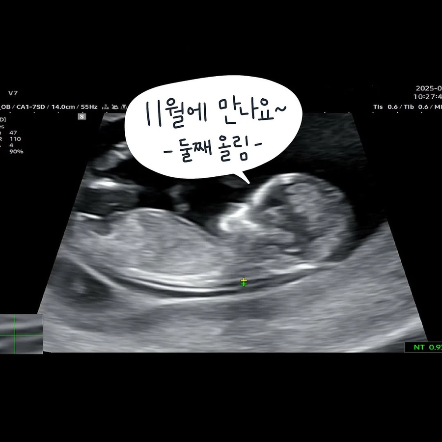 남편이 임신기간 내내 해준 것.manhwa_13.webp